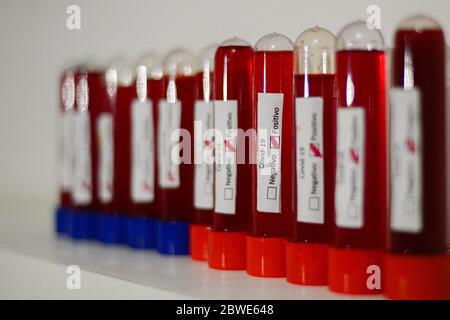 Florianópolis - SC, 29/05/2020 - testes de sangue do COVID-19.. Foto: Eduardo Valente/iShoot (Foto: Eduardo Valente/iShoot/Alamy (Upload com legenda e Stockfoto