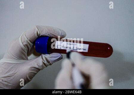 Florianópolis - SC, 29/05/2020 - testes de sangue do COVID-19.. Foto: Eduardo Valente/iShoot (Foto: Eduardo Valente/iShoot/Alamy (Upload com legenda e Stockfoto