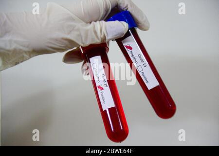 Florianópolis - SC, 29/05/2020 - testes de sangue do COVID-19.. Foto: Eduardo Valente/iShoot (Foto: Eduardo Valente/iShoot/Alamy (Upload com legenda e Stockfoto