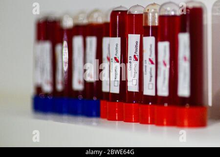 Florianópolis - SC, 29/05/2020 - testes de sangue do COVID-19.. Foto: Eduardo Valente/iShoot (Foto: Eduardo Valente/iShoot/Alamy (Upload com legenda e Stockfoto