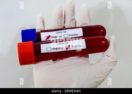 Florianópolis - SC, 29/05/2020 - testes de sangue do COVID-19.. Foto: Eduardo Valente/iShoot (Foto: Eduardo Valente/iShoot/Alamy (Upload com legenda e Stockfoto