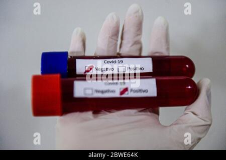 Florianópolis - SC, 29/05/2020 - testes de sangue do COVID-19.. Foto: Eduardo Valente/iShoot (Foto: Eduardo Valente/iShoot/Alamy (Upload com legenda e Stockfoto