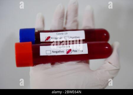 Florianópolis - SC, 29/05/2020 - testes de sangue do COVID-19.. Foto: Eduardo Valente/iShoot (Foto: Eduardo Valente/iShoot/Alamy (Upload com legenda e Stockfoto