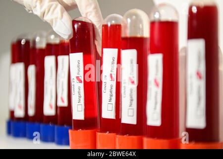 Florianópolis - SC, 29/05/2020 - testes de sangue do COVID-19.. Foto: Eduardo Valente/iShoot (Foto: Eduardo Valente/iShoot/Alamy (Upload com legenda e Stockfoto