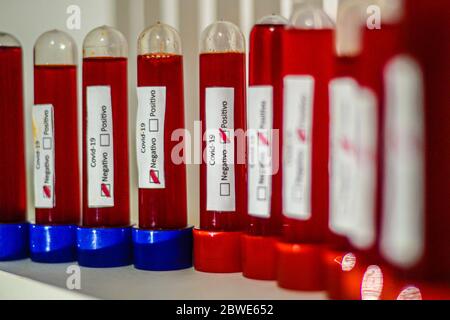 Florianópolis - SC, 29/05/2020 - testes de sangue do COVID-19.. Foto: Eduardo Valente/iShoot (Foto: Eduardo Valente/iShoot/Alamy (Upload com legenda e Stockfoto