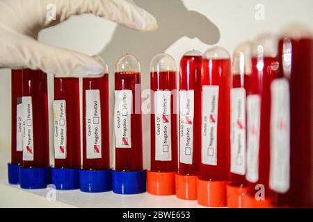 Florianópolis - SC, 29/05/2020 - testes de sangue do COVID-19.. Foto: Eduardo Valente/iShoot (Foto: Eduardo Valente/iShoot/Alamy (Upload com legenda e Stockfoto