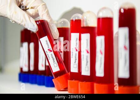 Florianópolis - SC, 29/05/2020 - testes de sangue do COVID-19.. Foto: Eduardo Valente/iShoot (Foto: Eduardo Valente/iShoot/Alamy (Upload com legenda e Stockfoto