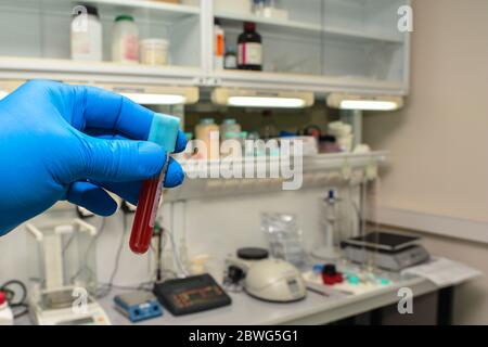 Laboruntersuchung einer biologischen Probe. Eine Handschuhhandschuhen hält ein Reagenzglas. Stockfoto