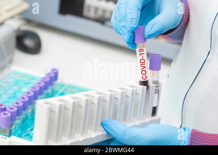 Arzthand Entnahme eines Blutprobenröhrchens aus einem Rack mit Analysemaschinen im Labor Hintergrund / Techniker hält Blutröhrchen mit Coronavirus po Stockfoto