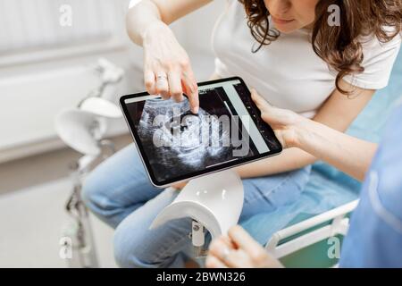 Medizinische Geräte mit Ultraschall-Scan des ungeborenen Kindes auf einem digitalen Tablet während einer Untersuchung mit einer schwangeren Frau im Büro, abgeschnitten Ansicht ohne Gesichter Stockfoto