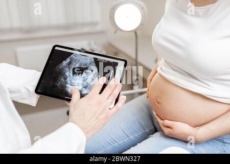 Arzt mit Ultraschall-Scan des ungeborenen Kindes auf einem digitalen Tablet während einer Untersuchung mit einer schwangeren Frau im Büro, beschnittene Ansicht ohne Gesichter Stockfoto