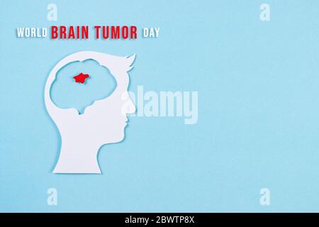 Welttag Des Hirntumors. Draufsicht des geschnittenen Papierhirns mit rotem Tumor auf hellblauem Hintergrund. Speicherplatz für Werbekunden kopieren. Stockfoto