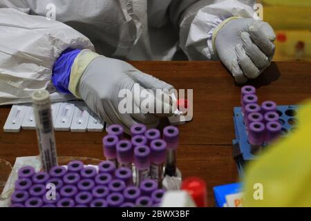 Yogyakarta, Indonesien. Juni 2020. Ein Gesundheitsarbeiter führt Tests durch, die Immunglobulin-Antikörper gegen Coronavirus im Blut am Beringharjo, Yogyakarta, Indonesien, während COVID-19 Antikörpertests, 3. Juni 2020 aufspüren. (Foto: Devi Rahman/INA Photo Agency/Sipa USA) Quelle: SIPA USA/Alamy Live News Stockfoto