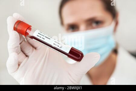 Hand in blauen Handschuhen hält Fläschchen mit Blut, Etikett Coronavirus Test, negatives Ergebnis, verschwommen Frau in blauen Mund Maske Gesicht Hintergrund. Covid 19 testi Stockfoto
