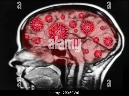2019 NCoV-Corona Virus Zellausbruch und Coronaviren Influenza roter Hintergrund Konzept gefährliche Grippe Schuss Pandemie medizinisches Gesundheitsrisiko mit Krankheit. Stockfoto