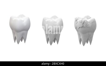 Gebrochene Backenzähne Zahn und ganzer Zahn isoliert auf weißem Hintergrund. 3d-Illustration Stockfoto