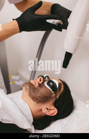 Frau mit einer Carbon Peel Schönheitsbehandlung Stockfoto