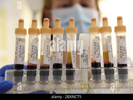 Leipzig, Deutschland. Mai 2020. Serumröhrchen mit Blutproben von Patienten werden im zentralen medizinischen Labor der Klinik St. Georg in Leipzig verarbeitet. Serumproben zur Antikörperbestimmung von Corona-Viren werden in Gefrierschränken für weitere Studien aufbewahrt. Quelle: Waltraud Grubitzsch/dpa-Zentralbild/ZB/dpa/Alamy Live News Stockfoto