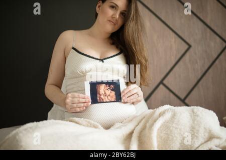 Schwangere Frau mit Ultraschallbild. Konzept der Schwangerschaft, Gesundheitsversorgung, Gynäkologie, Medizin. Junge Mutter wartet auf das Baby. Stockfoto