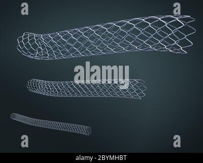 Drei Metallstents zur Implantation und Unterstützung der Durchblutung in Blutgefäße - 3d-Illustration Stockfoto