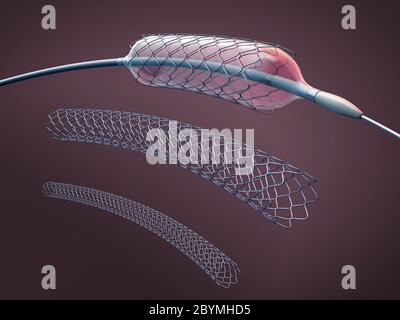 Drei Metallstents zur Implantation und Unterstützung der Durchblutung in Blutgefäße und Katheter - 3d-Illustration Stockfoto