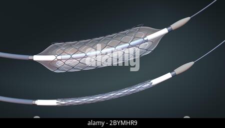 Stent und Katheter zur Implantation in Blutgefäße mit leerem und gefülltem Ballon - 3d-Illustration Stockfoto