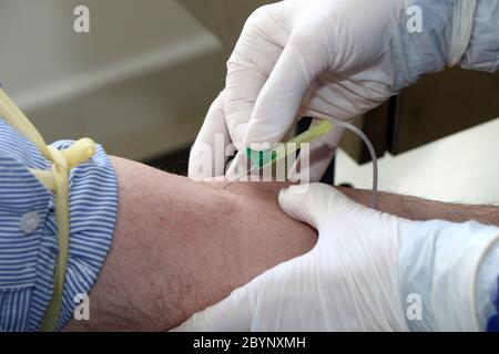 Die Krankenschwester nimmt eine Blutprobe von einem Patienten für einen Bluttest wegen eines möglichen Falls von Coronavirus covid-19 Stockfoto