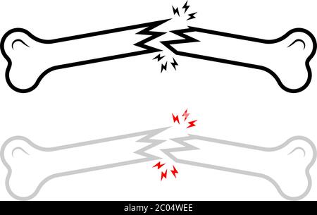 Human Broken Bone, Knochenbruch Vektorgrafik Stock Vektor