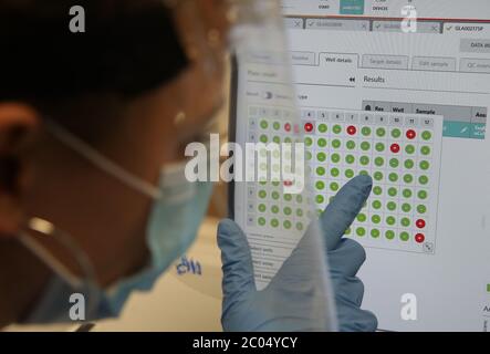 Ein Wissenschaftler sieht einen Bildschirm mit Testergebnissen an. Mit den roten Punkten eine positive Probe und die grünen Punkte ein Negativ während der Arbeit am Lighthouse Laboratory am Queen Elizabeth University Hospital in Glasgow, das Coronavirus-Abstriche mit Verdacht auf COVID-19-Infektionen im anhaltenden Kampf gegen das Coronavirus empfängt und analysiert. Schottland setzt in Phase eins des Plans der schottischen Regierung zur schrittweisen Aufhebung der Lockdown fort. Stockfoto