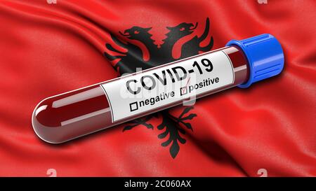 Flagge Albaniens winkend im Wind mit einem positiven Covid-19 Blutteströhrchen, 3D-Illustrationskonzept für Bluttests zur Diagnose des neuen Coronavirus Stockfoto