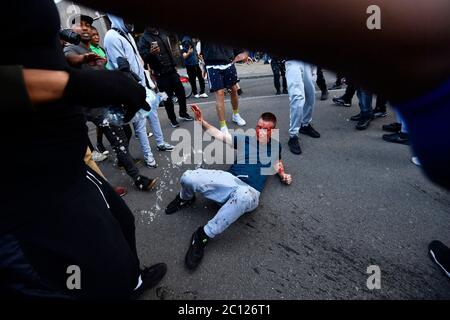 Black Lives Matter Proteste NOTIEREN GRAFISCHE INHALTE EIN Protestant mit Gesichtsverletzungen, nachdem er vor der Waterloo Station in London angegriffen wurde. PA-Foto. Bilddatum: Samstag, 13. Juni 2020. Weltweite Proteste haben nach dem Tod von George Floyd stattgefunden, der am 25. Mai in Polizeigewahrsam in der US-Stadt Minneapolis getötet wurde. Siehe PA Geschichte POLIZEI Floyd. Bildnachweis sollte lauten: Victoria Jones/PA Wire Stockfoto