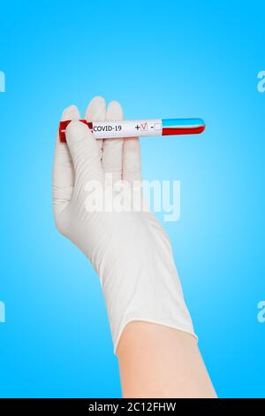 Hand in mediaclal Handschuh hält Blut-Testschlauch mit positivem Tag, Testschlauch mit Blut für 2019 NCoV Analyse. Laboruntersuchungen des Blutes des Patienten. Stockfoto