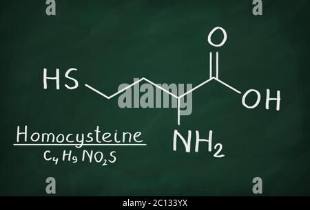 Chemische Formel von Homocystein auf einer Tafel Stockfoto