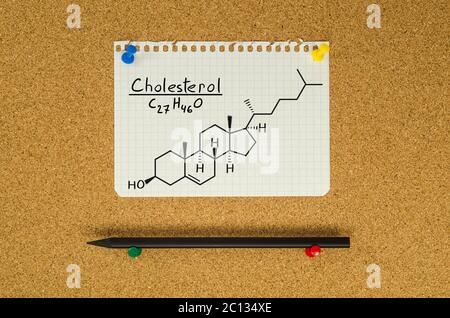 Chemische Formel von Cholesterin auf dem Schwarzen Brett Stockfoto