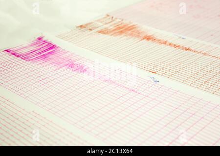 Erdbeben Welle auf eine Grafik, Papier Stockfoto