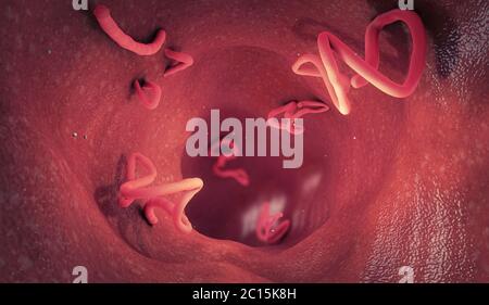 Bandwurmbefall im menschlichen Darm - 3d-Illustration Stockfoto