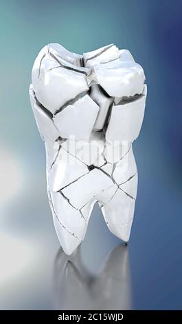 3D-Darstellung eines gebrochen weißen Zahn Stockfoto