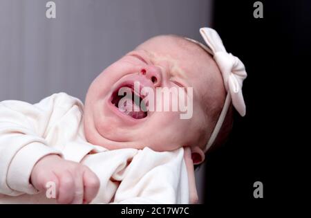 Ein Monat altes Mädchen schreit und weint in den Armen ihrer Mutter mit einer Stichwunde auf ihrem Kopf. Stockfoto