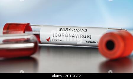 Probenfläschchen mit Blut, Etikett sagt SARS-CoV-2 Coronavirus, positives Ergebnis. Covid 19-Tests während des Ausbruchskonzepts Stockfoto