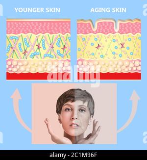 Die jüngere Haut und Hautalterung. Elastin und Kollagen. Ein Diagramm von jungen und alten Gesicht zeigt der Rückgang der Kollagen und Elastin. Stockfoto