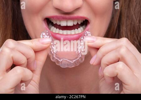 Nahaufnahme von einer Frau Hand Transparent Ausrichter in Zähne Stockfoto