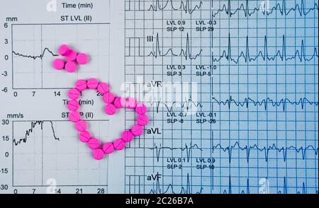 EKG- oder EKG-Diagramm (Elektrokardiogramm). EST ( Übung Stress Test ) Ergebnis und rosa Herzform aus Warfarin Tablette Pillen gemacht. Warfarin Stockfoto