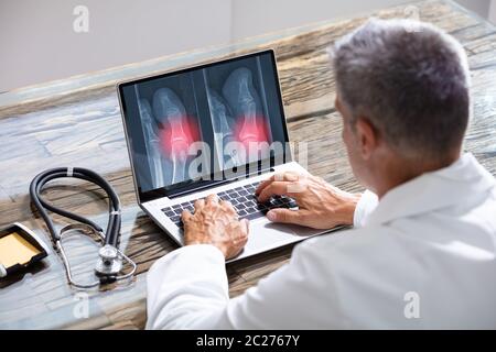 Arzt Suchen am Fuß X-ray auf Laptop mit Stethoskop Stockfoto