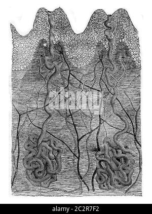 Schneiden der Haut in den weißen Mann, Vintage gravierte Illustration. Magasin Pittoresque 1873. Stockfoto