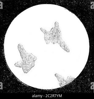 Amöbe (Amoeba princeps), 100 mal vergrößert, Vintage gravierte Illustration. Magasin Pittoresque 1873. Stockfoto