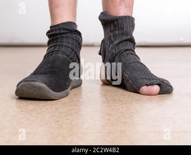 Einen männlichen Fuß in Pantoffeln, andere in Socke mit Loch Stockfoto