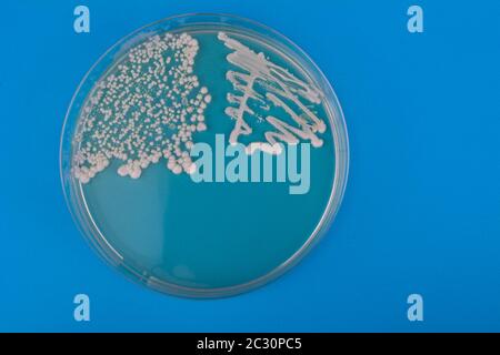 Petrischale mit Bakterien auf blauem Hintergrund. Candida albicans Bakterien auf Agarplatte Stockfoto