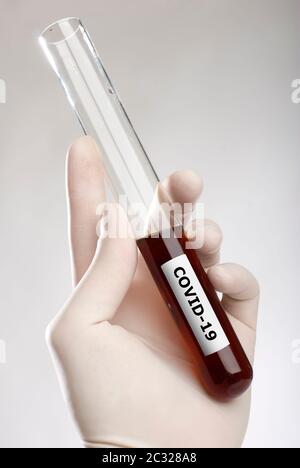 Coronavirus Konzept. COVID-19. Hand hält Blut im Reagenzglas dicht Stockfoto