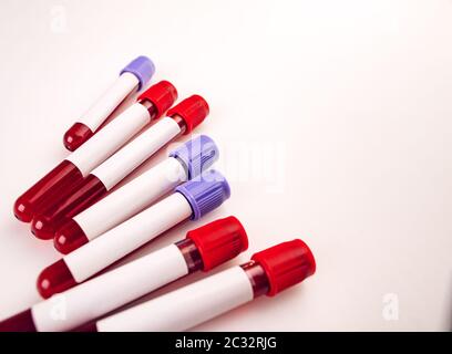 Probenröhrchen zur Blutentnahme mit leerem Testaufkleber Stockfoto