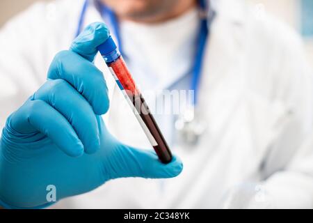 Ansicht eines Arztes, der eine fiktive, möglicherweise infizierte Reagenzglasblutprobe hält. Stockfoto